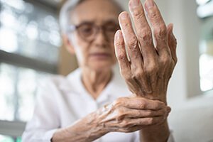 RHEUMATOID ARTHRITIS