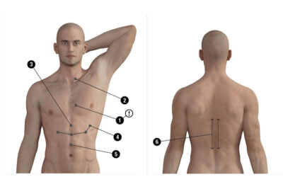 endocrin