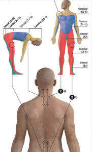 back pain treatment 2