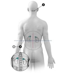 Traumatologie